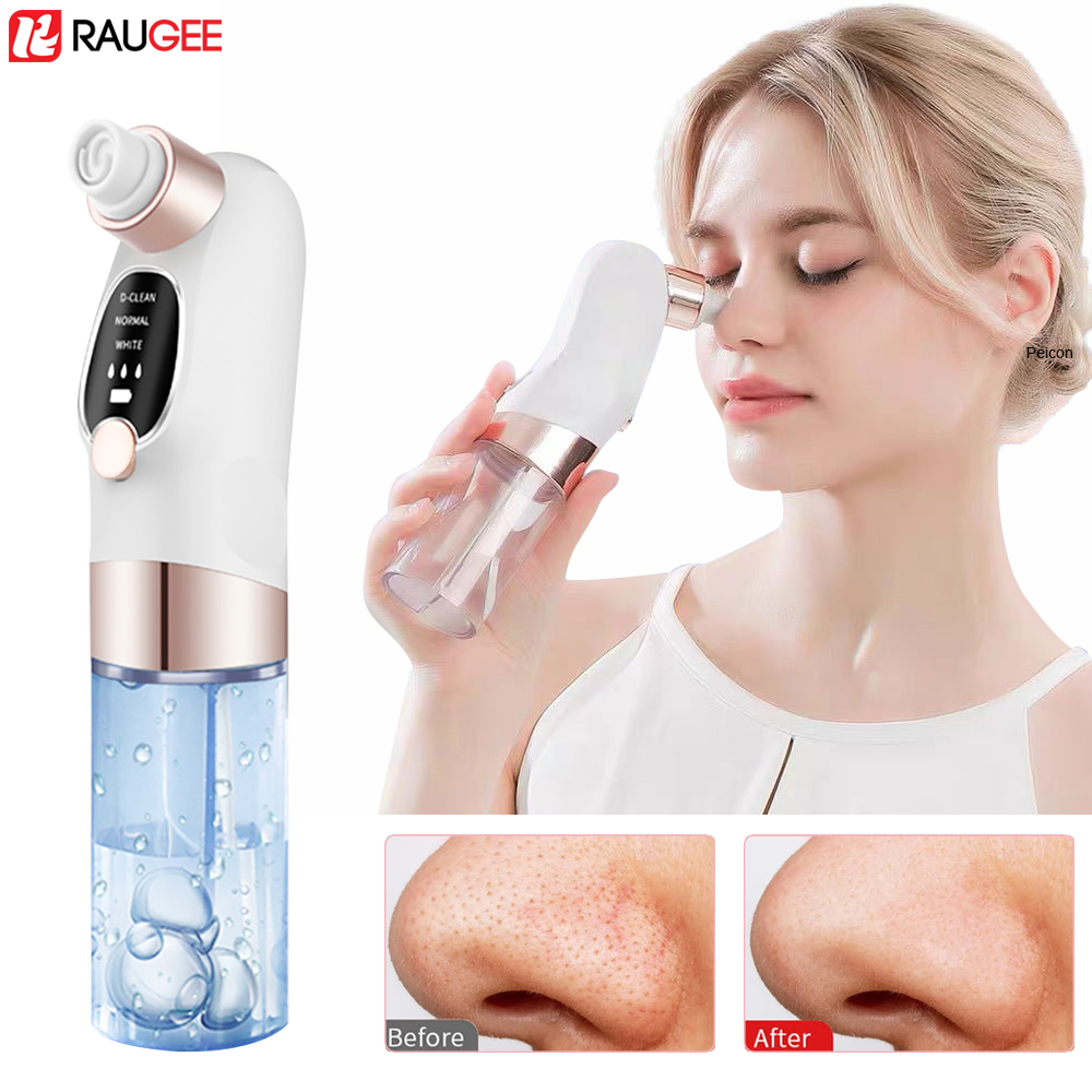Blackhead Remover Electric Bla - Air Bubble Remover บทวิจารณ์และราคา